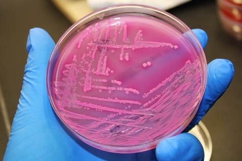 E.coli bacteria is a harmful bacteria